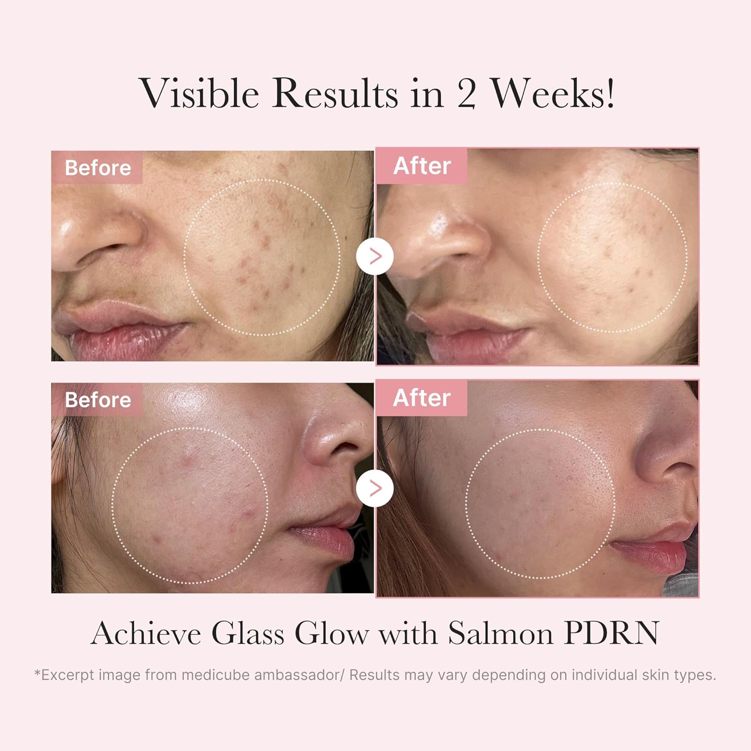 Kit de prueba Medicube PDRN