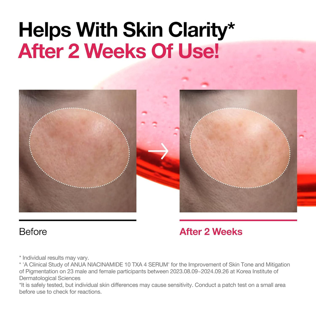 Anua Serum Niacinamida + TXA