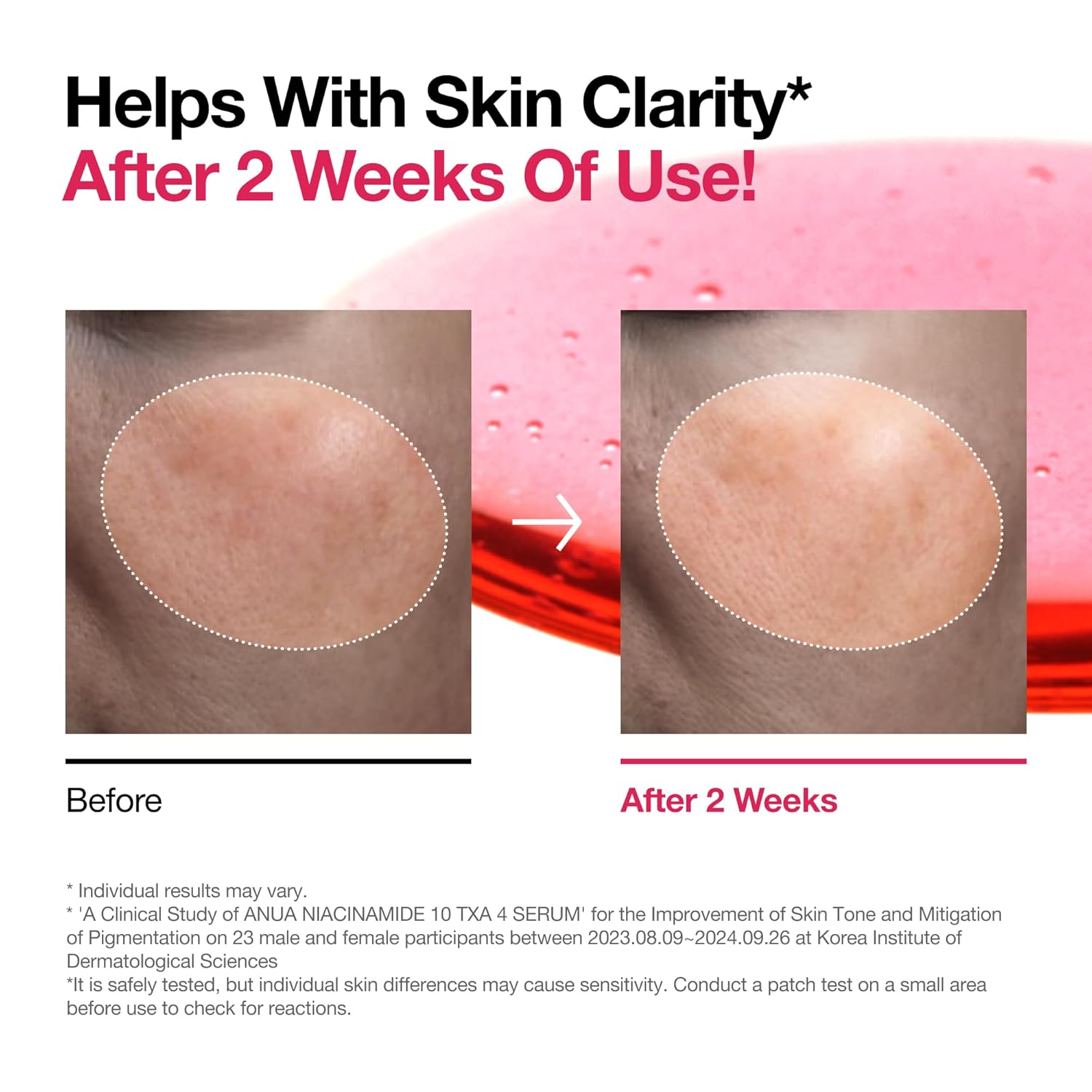 Anua Serum Niacinamida + TXA