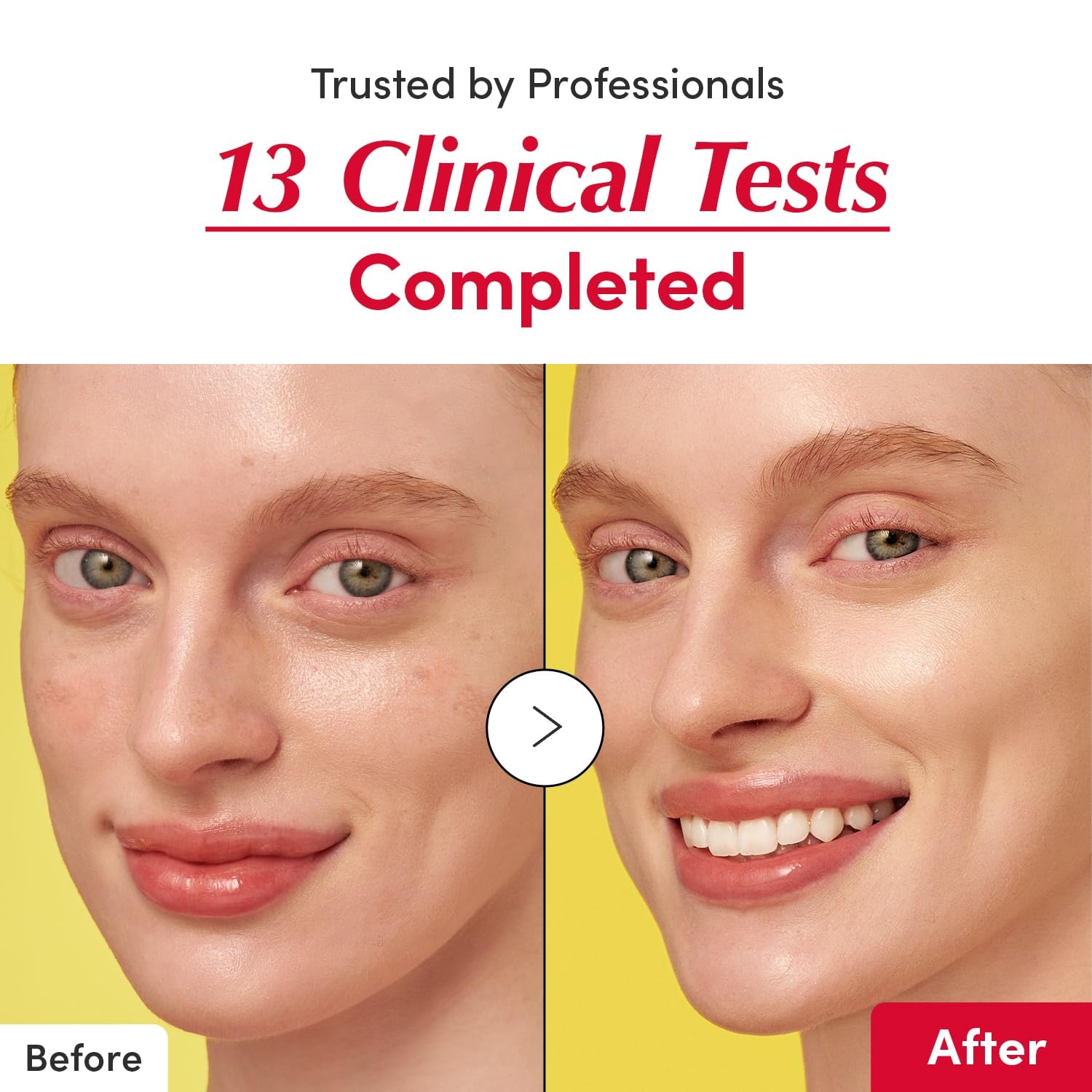 EQQUALBERRY Suero Iluminador de Vitamina C con Niacinamida