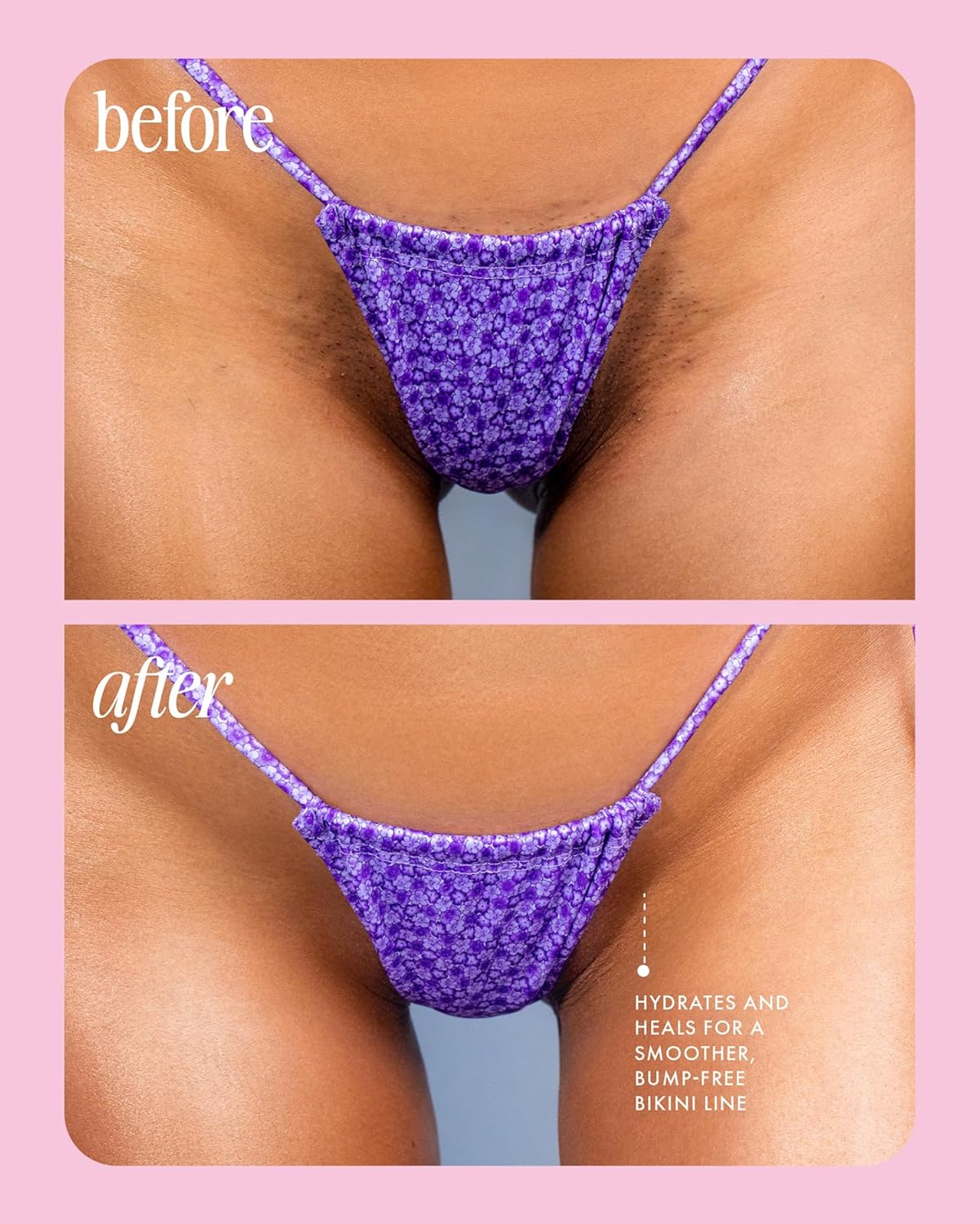 Truly Cooka Ingrown Concentrate