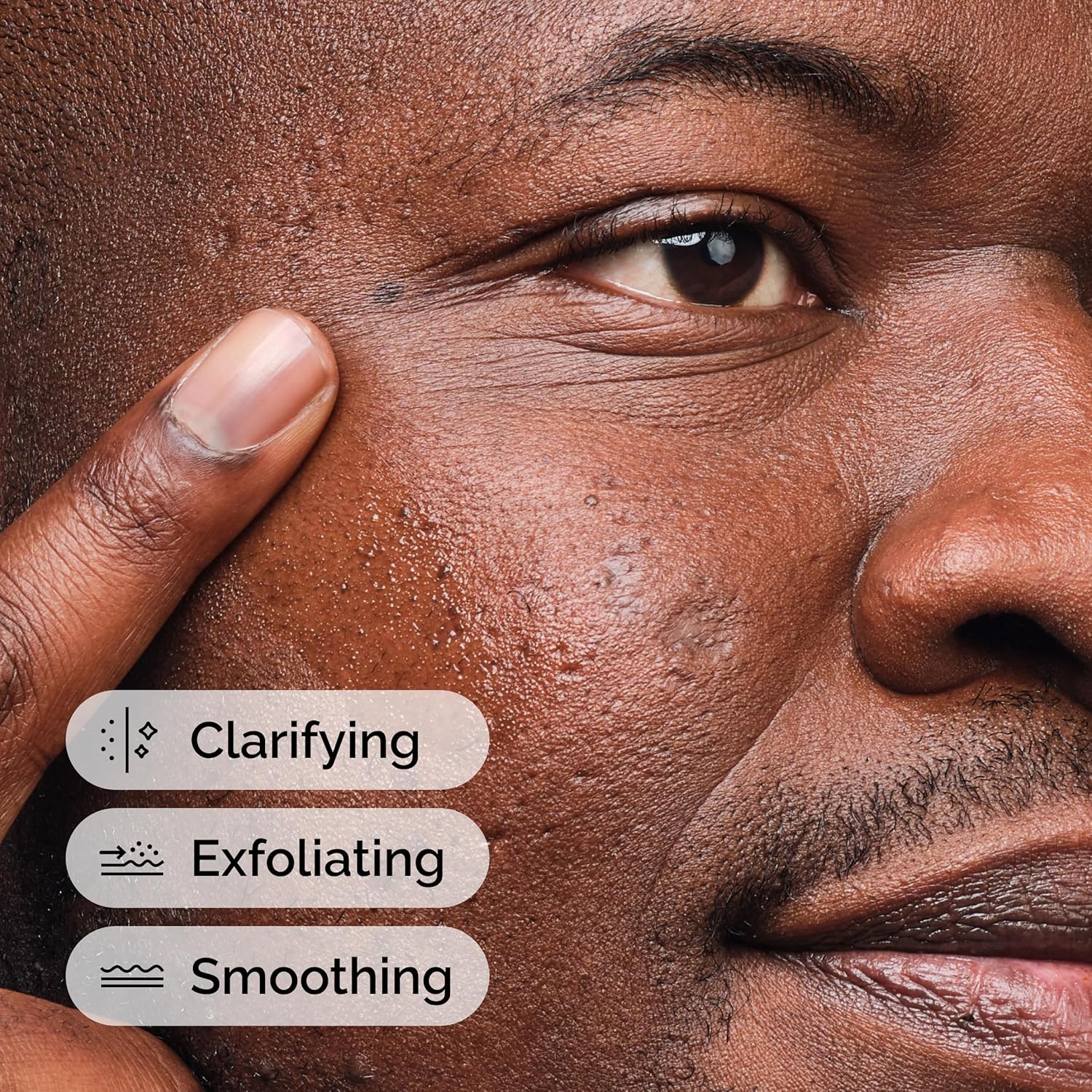 The Ordinary Solución de Ácido Salicílico 2%