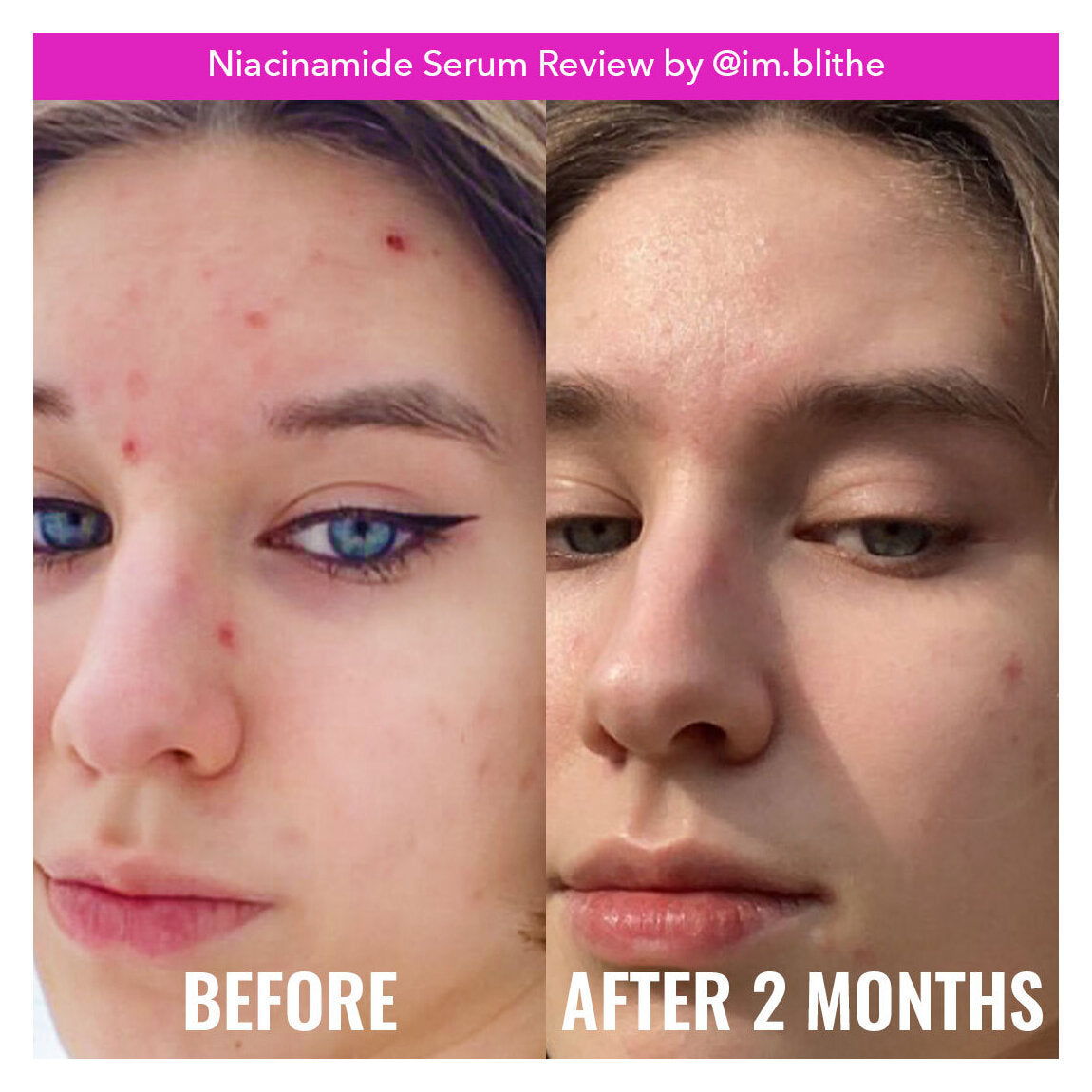 Good Molecules Serum Niacinamida